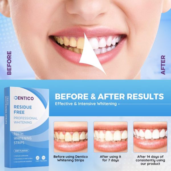 Dentico PAP+ Professional Level Teeth Whitening Strips – 14 Day Course - Image 6